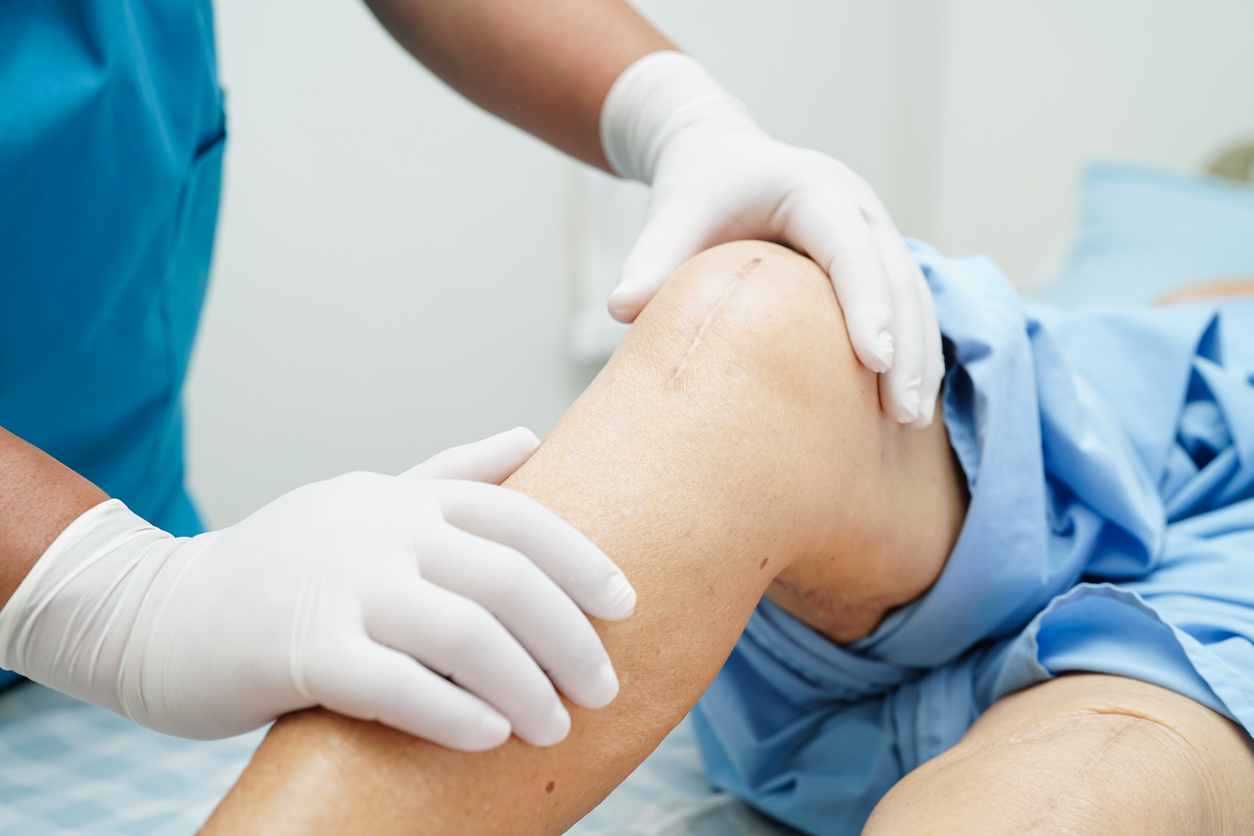 Knee Replacements What to Expect Before, During, and After Surgery